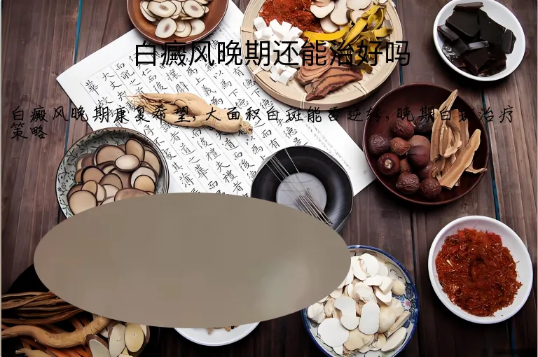 白癜风晚期还能治好吗