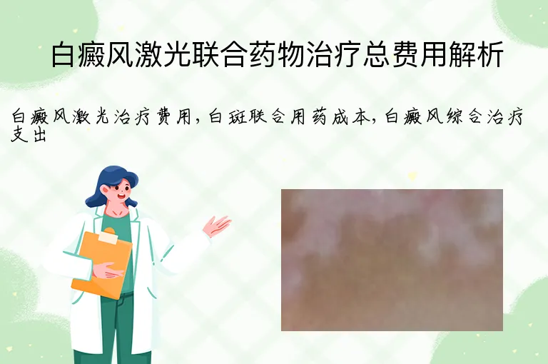 白癜风激光联合药物治疗总费用解析