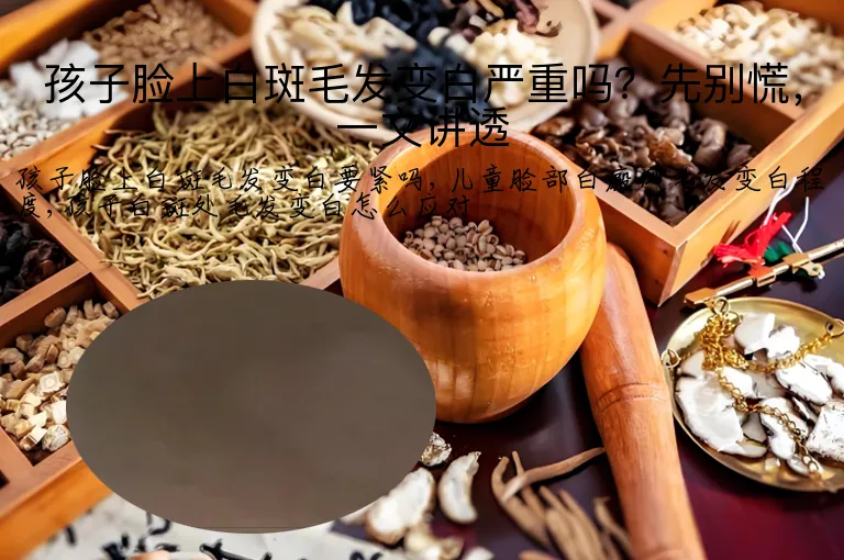 孩子脸上白斑毛发变白严重吗?先别慌,一文讲透