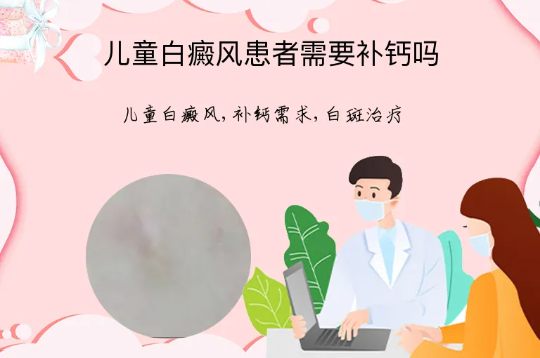 儿童白癜风患者需要补钙吗
