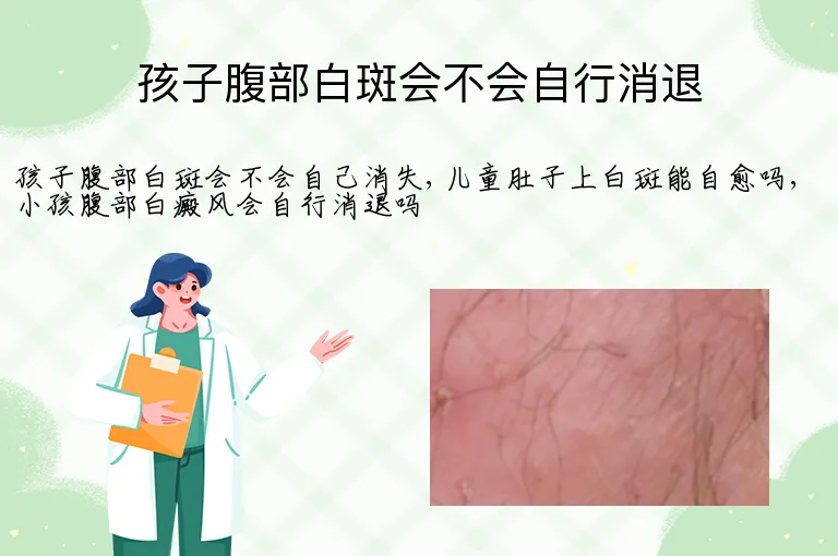 孩子腹部白斑会不会自行消退