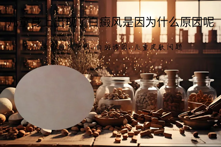 儿童身上出现了白癜风是因为什么原因呢