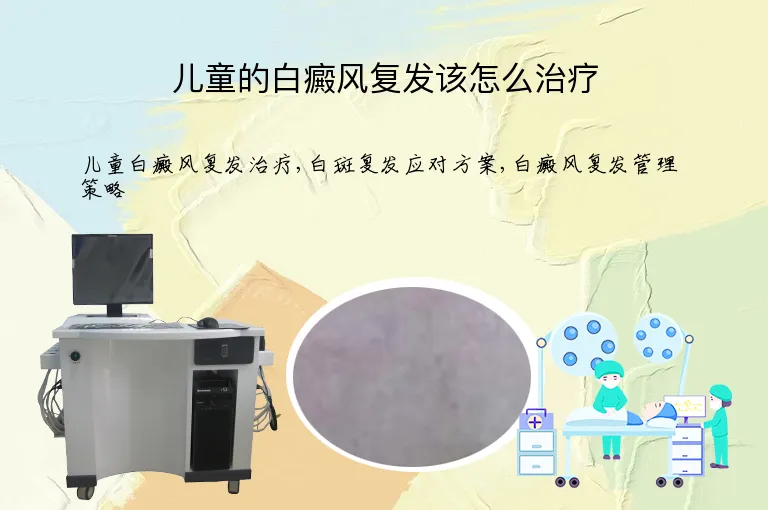 儿童的白癜风复发该怎么治疗