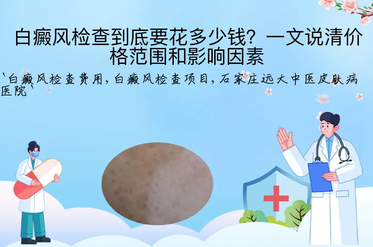 白癜风检查到底要花多少钱?一文说清价格范围和影响因素