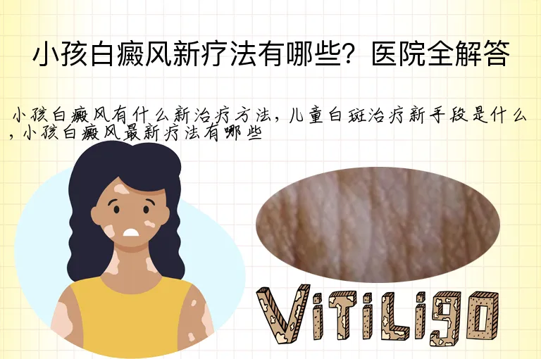 小孩白癜风新疗法有哪些?医院全解答