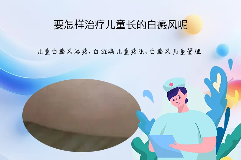 要怎样治疗儿童长的白癜风呢