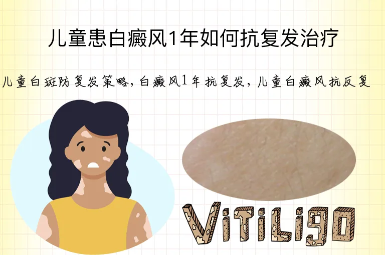 儿童患白癜风1年如何抗复发治疗