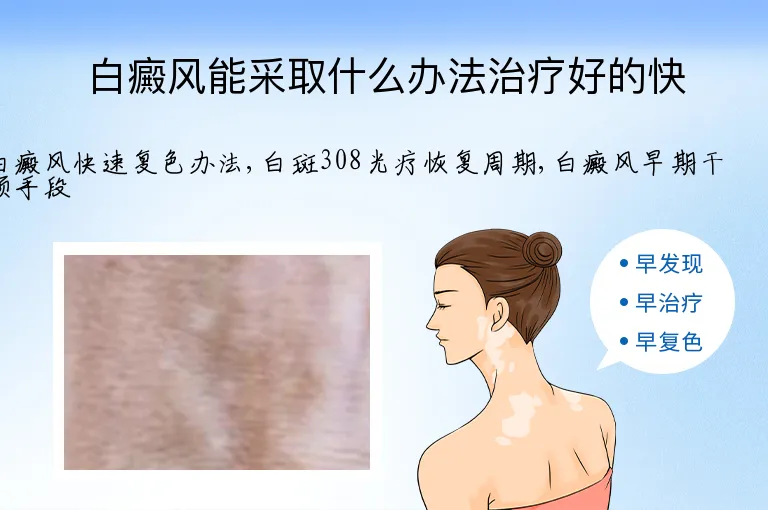 白癜风能采取什么办法治疗好的快