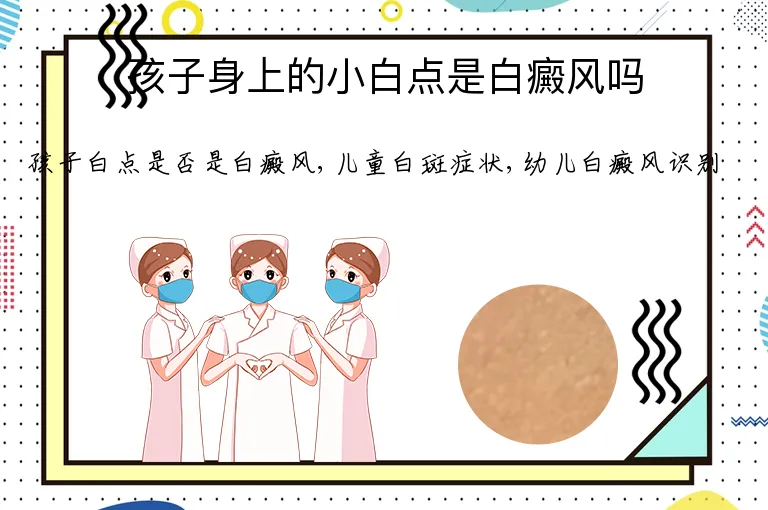 孩子身上的小白点是白癜风吗