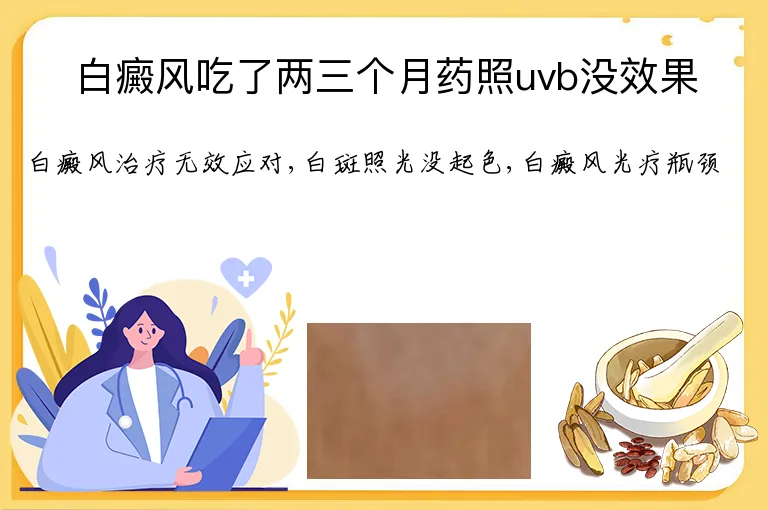 白癜风吃了两三个月药照uvb没效果