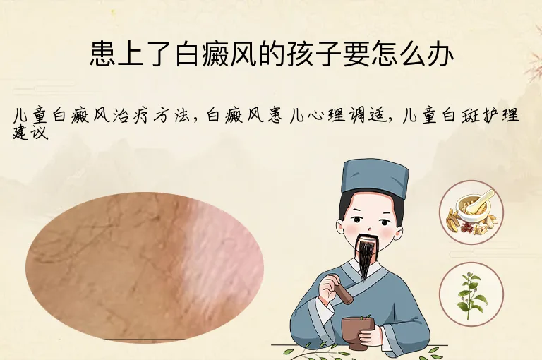 患上了白癜风的孩子要怎么办