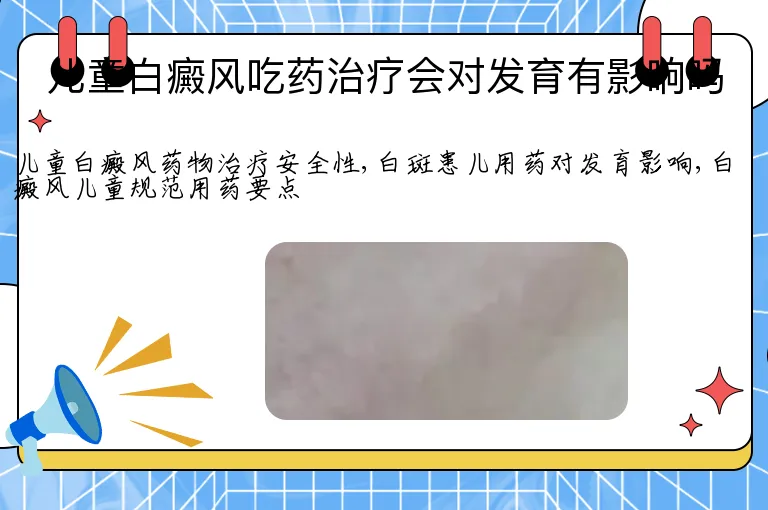 儿童白癜风吃药治疗会对发育有影响吗