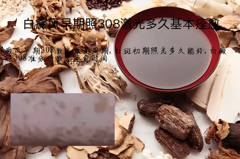 白癜风早期照308激光多久基本痊愈