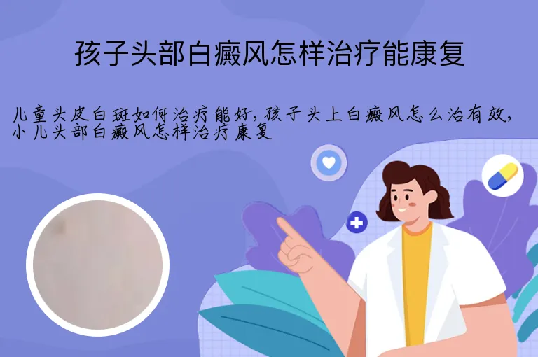 孩子头部白癜风怎样治疗能康复