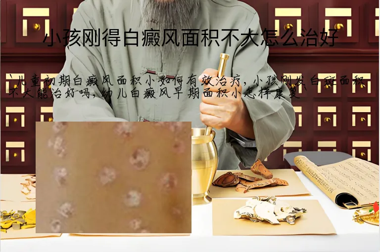小孩刚得白癜风面积不大怎么治好
