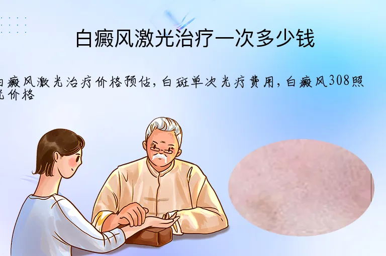 白癜风激光治疗一次多少钱
