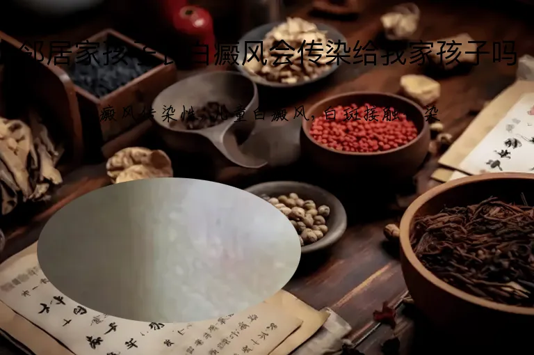 邻居家孩子长白癜风会传染给我家孩子吗