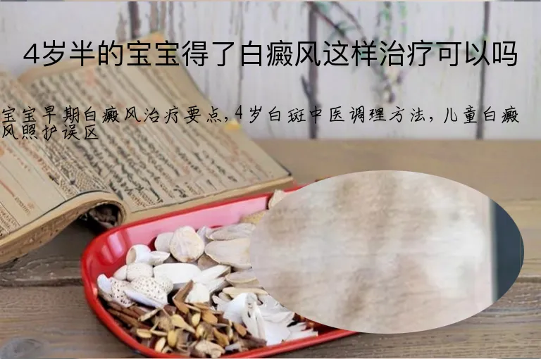 4岁半的宝宝得了白癜风这样治疗可以吗
