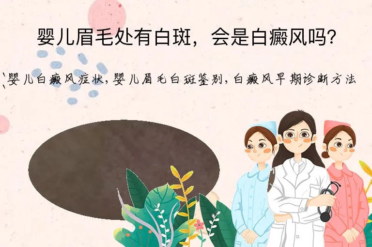 婴儿眉毛处有白斑,会是白癜风吗?