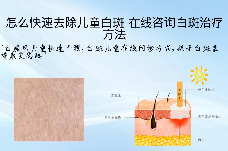 怎么快速去除儿童白斑 在线咨询白斑治疗方法