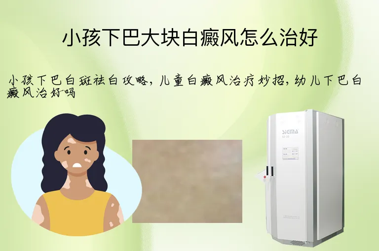 小孩下巴大块白癜风怎么治好