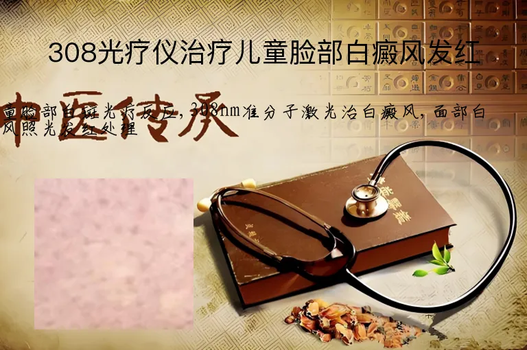 308光疗仪治疗儿童脸部白癜风发红