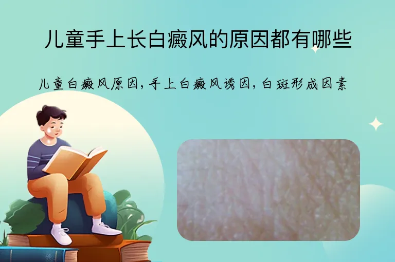 儿童手上长白癜风的原因都有哪些