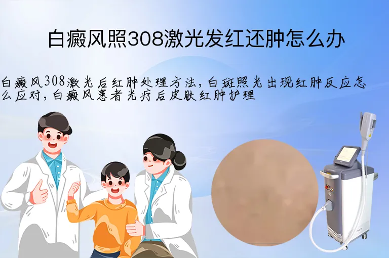 白癜风照308激光发红还肿怎么办