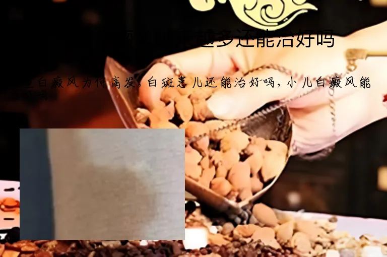 儿童白癜风越来越多还能治好吗