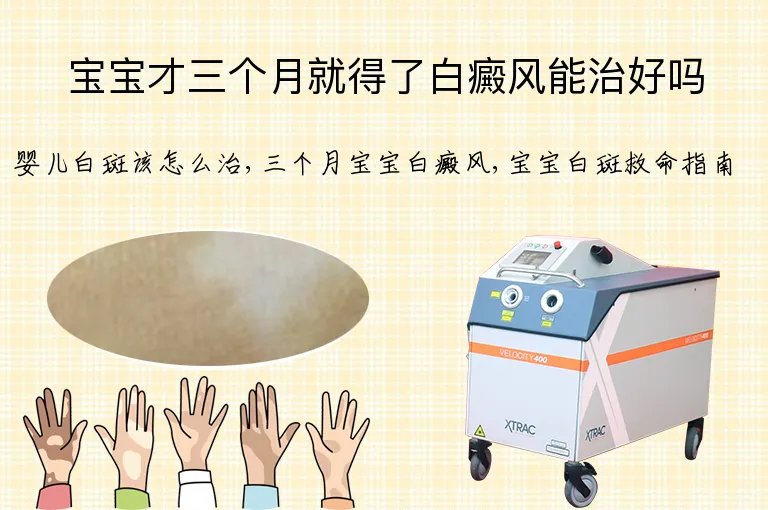 宝宝才三个月就得了白癜风能治好吗