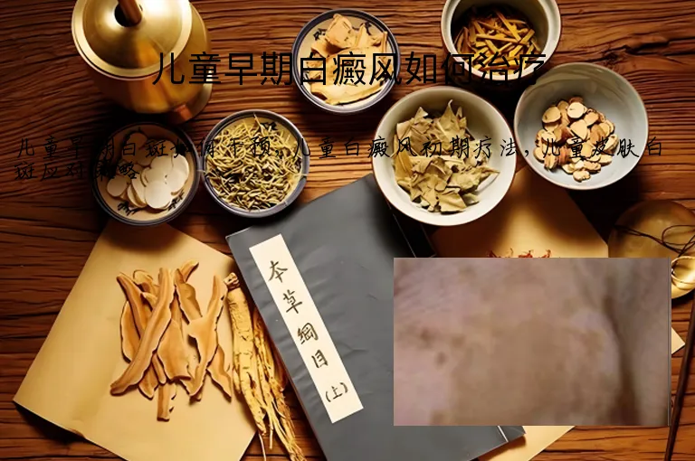 儿童早期白癜风如何治疗