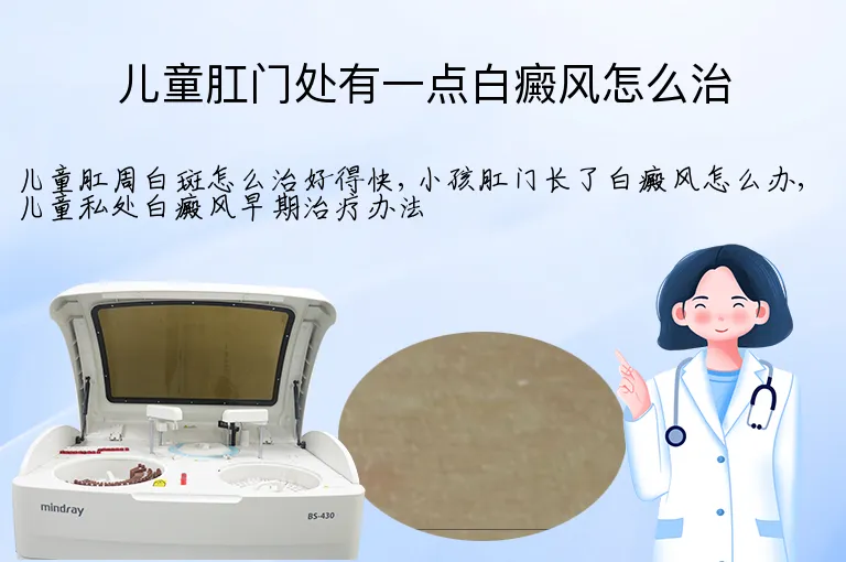 儿童肛门处有一点白癜风怎么治
