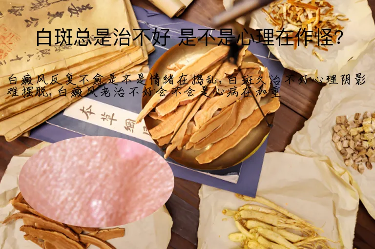 白斑总是治不好 是不是心理在作怪?