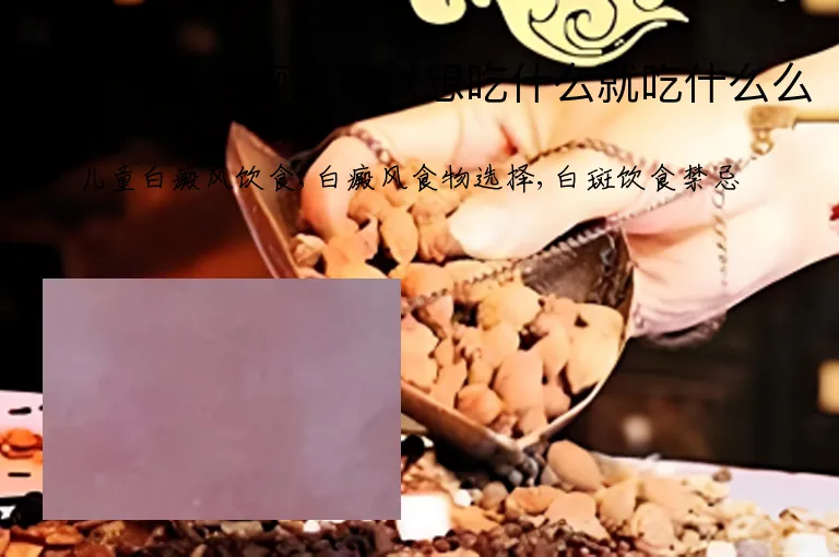 儿童患上白癜风可以想吃什么就吃什么么