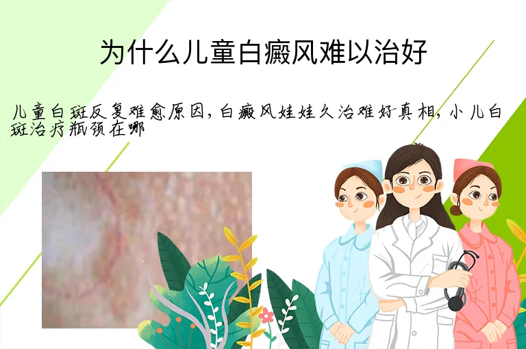为什么儿童白癜风难以治好