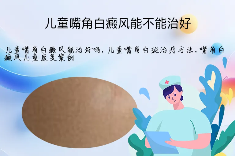 儿童嘴角白癜风能不能治好