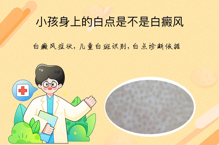 小孩身上的白点是不是白癜风