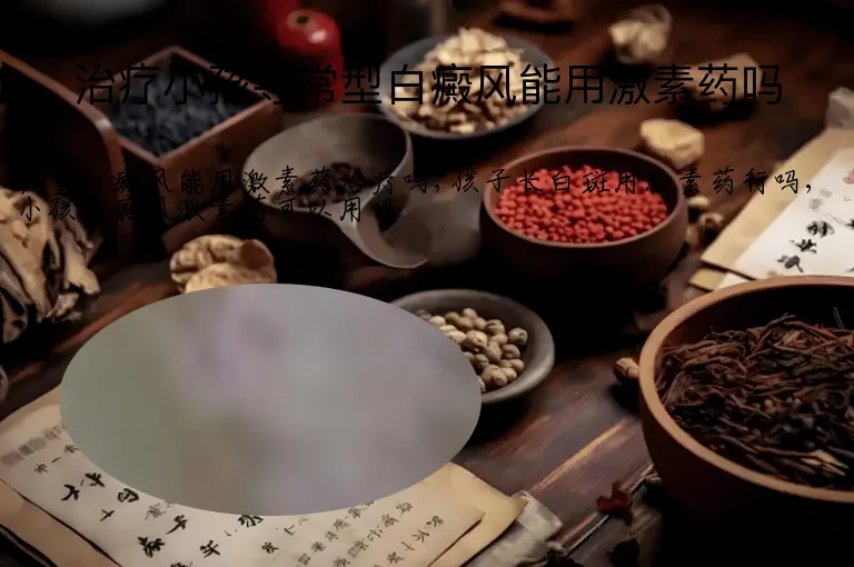 治疗小孩寻常型白癜风能用激素药吗
