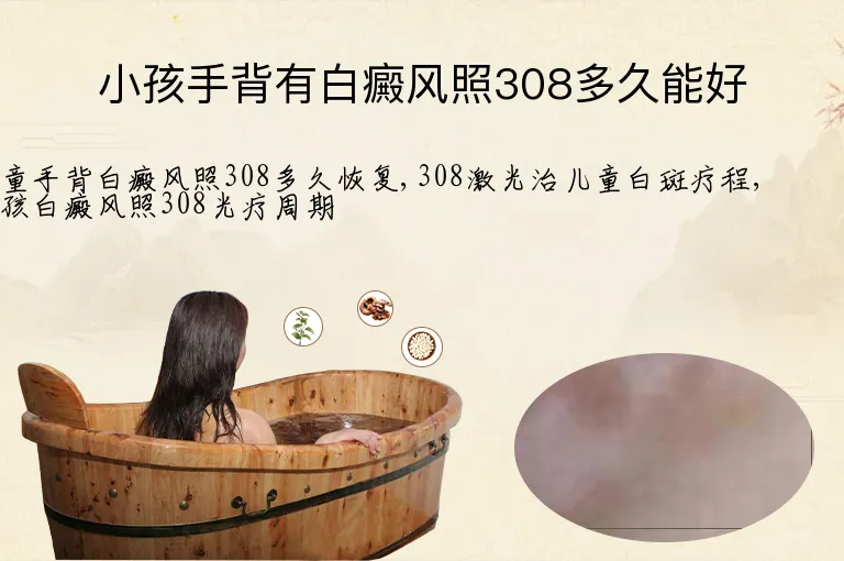 小孩手背有白癜风照308多久能好
