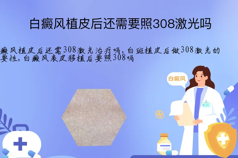 白癜风植皮后还需要照308激光吗