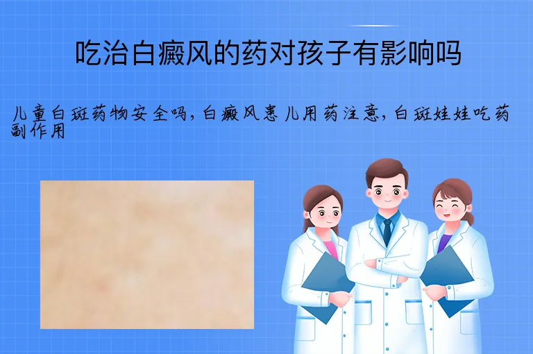 吃治白癜风的药对孩子有影响吗