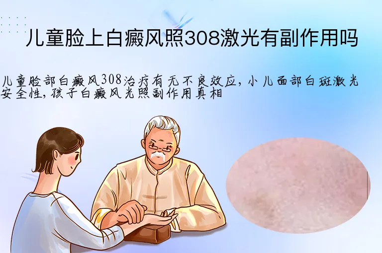儿童脸上白癜风照308激光有副作用吗