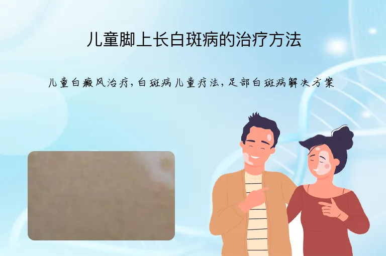 儿童脚上长白斑病的治疗方法