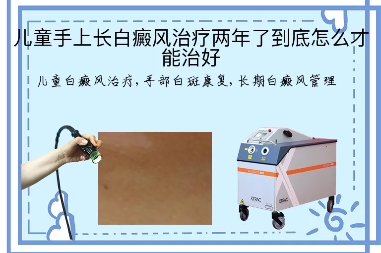 儿童手上长白癜风治疗两年了到底怎么才能治好
