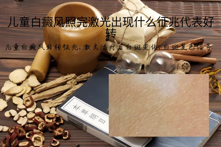 儿童白癜风照完激光出现什么征兆代表好转