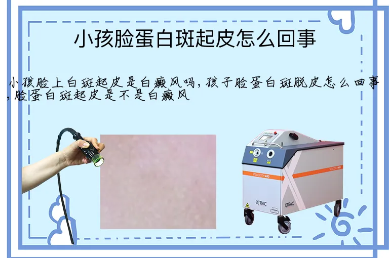 小孩脸蛋白斑起皮怎么回事