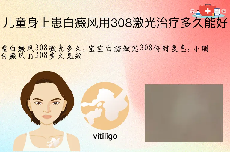 儿童身上患白癜风用308激光治疗多久能好
