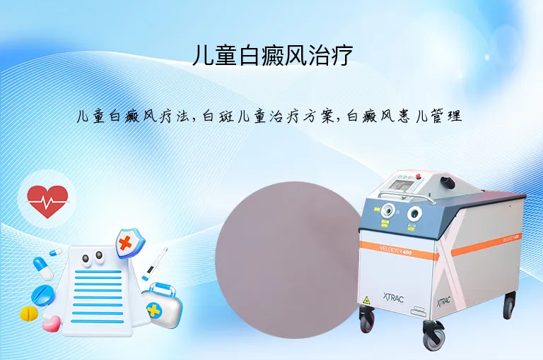 儿童白癜风治疗