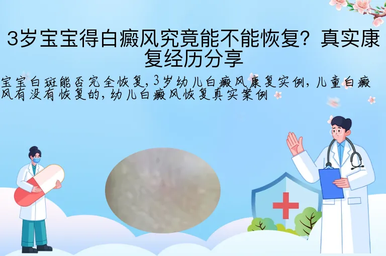 3岁宝宝得白癜风究竟能不能恢复?真实康复经历分享