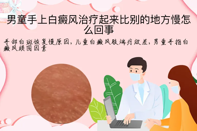 男童手上白癜风治疗起来比别的地方慢怎么回事